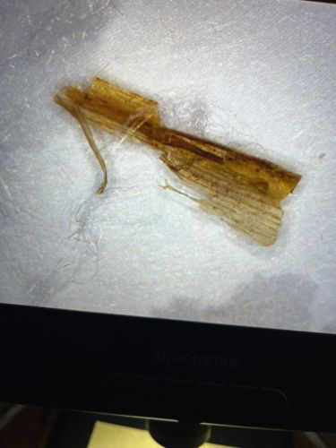 Not identifiable as an insect or bug; appears to be plant or wood fiber