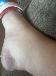 No insect or bug is visible in the image