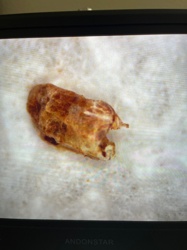 It is difficult to definitively identify the common name of the object in the image. Although it appears to be an exuvia (molted exoskeleton) of an insect, or possibly a dried up insect remains, its exact common name cannot be determined without clearer details or a more complete specimen.