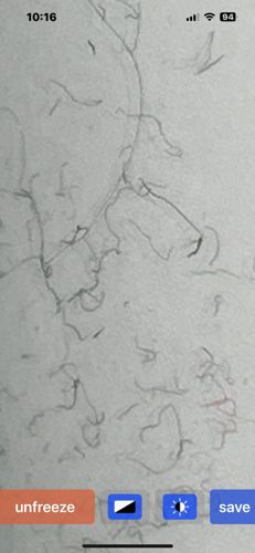 Nematode (Roundworm)