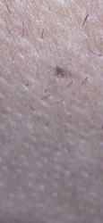 Blackberry Psyllid