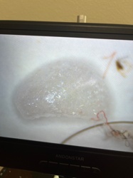 Aphid (possibly a shed skin or dead specimen)