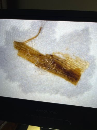 Unidentifiable organic material