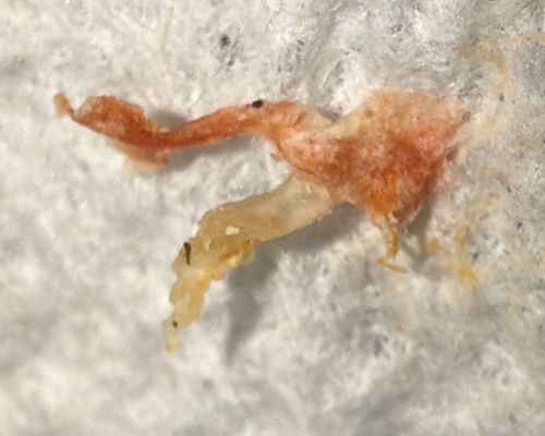 Inconclusive (Likely non-biological debris or organic tissue)
