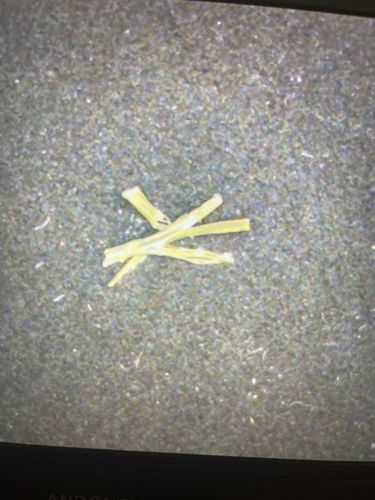 Nematode (likely a free-living or plant-parasitic type)