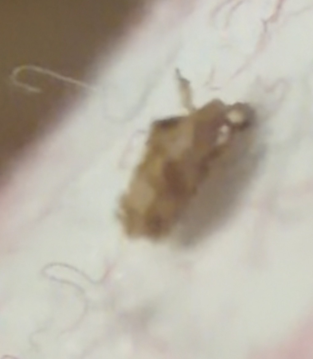 Bed Bug