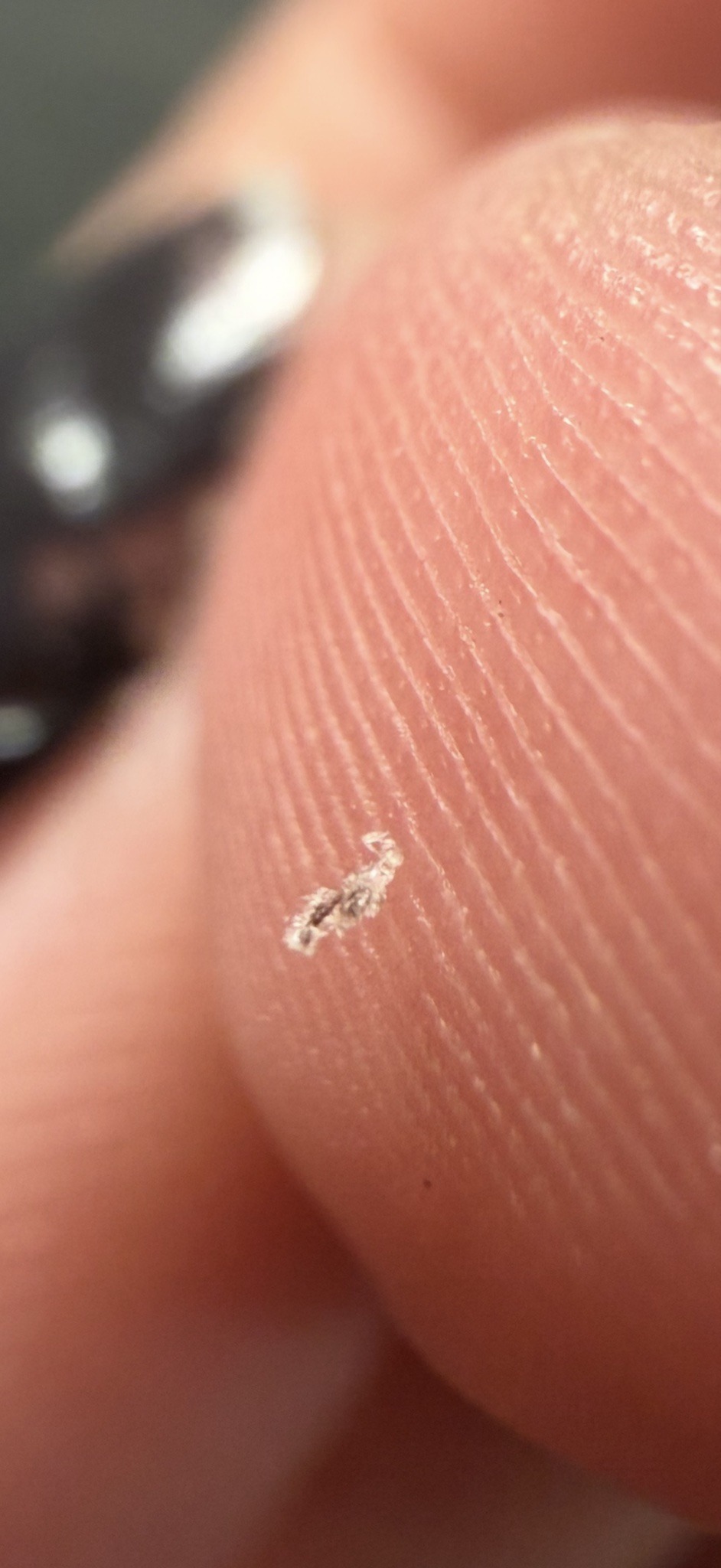 Body Louse (Nits/Egg stage shown)