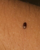 Tick