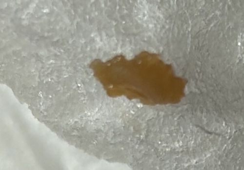 Bed Bug (Fecal Spot)