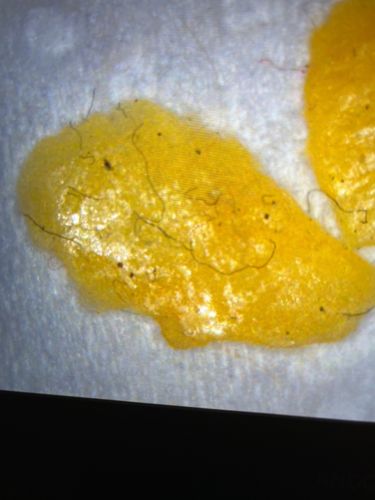 No insect identified