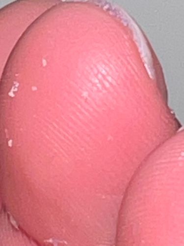 Not identifiable as an insect