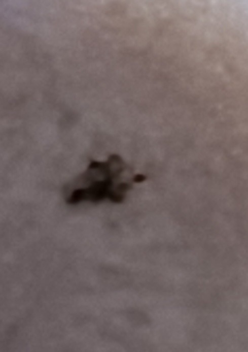 Masked Hunter (Nymph)