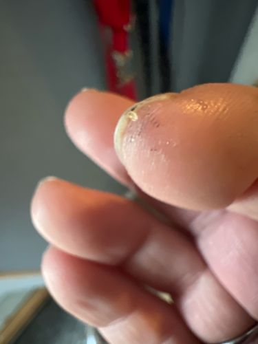 Too blurry to identify