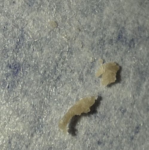 Not a Bug (likely skin flake, sebum, or debris)