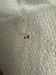 Unidentifiable insect remains/stain