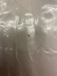Head Louse