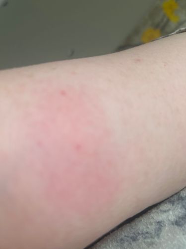 Mosquito
