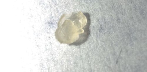 Tapeworm Segment (Proglottid)