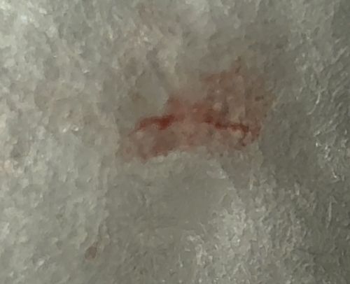 Unidentifiable organic stain (possibly crushed insect)