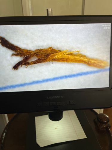 Not an insect or bug