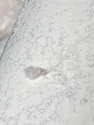 Bed Bug