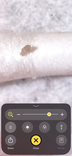 Bed Bug