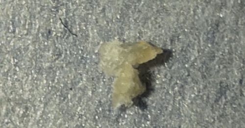 Not a Bug/Insect (Likely Food Crumb, Wax, or Debris)