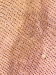 Not identifiable as an insect