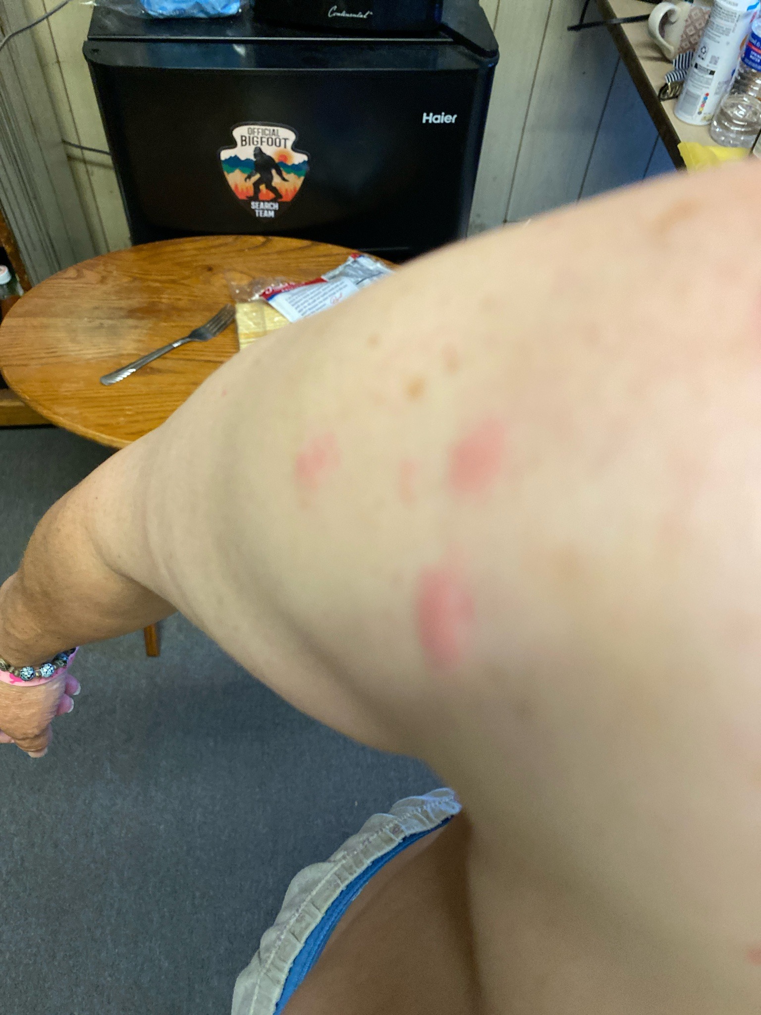 Bed bug