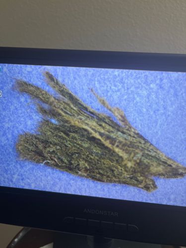 No insect or bug identifiable