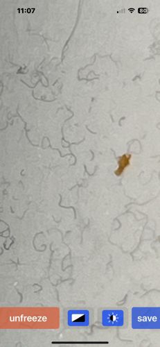 Unidentifiable Particle/Fibers (No identifiable insect)