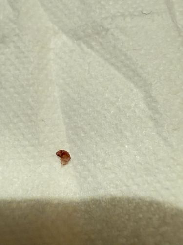 It is difficult to definitively identify the insect from the provided image due to its small size and lack of clear features. It appears to be a fragmented or very small insect specimen. It is not possible to provide an accurate identification with the current visual information. Without more distinctive features, I cannot confidently provide the requested details.