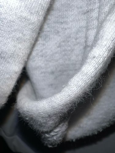 No insect identified