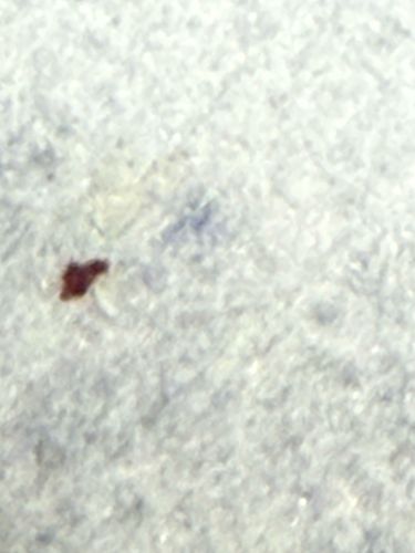 Bed Bug