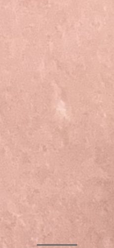 Unidentifiable insect