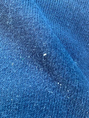 Body Louse or Head Louse Nit (Egg)