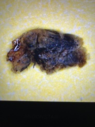 It is difficult to determine the exact common name due to the condition of the specimen, but it appears to be a heavily damaged/decomposed insect. Potentially an adult fly or some other small insect.