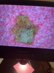 Not identifiable as an insect