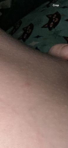 Unknown (No insect visible)