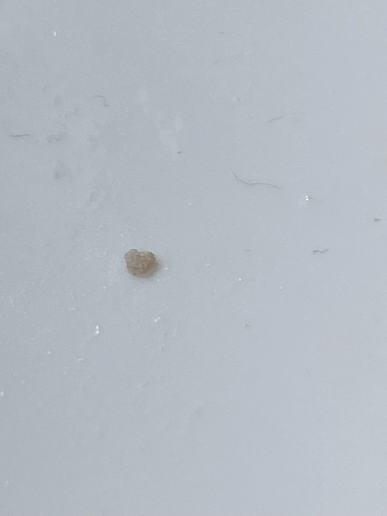 Globular Springtail