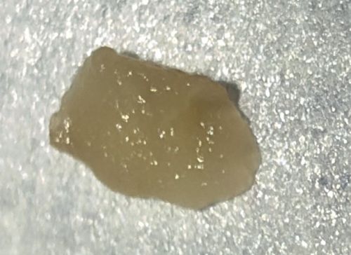 Tapeworm Proglottid (Segment)