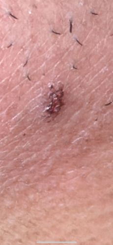 Tick
