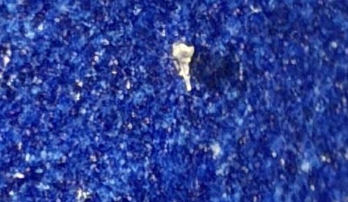 There is insufficient visual data to positively identify a bug.