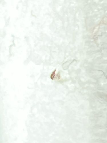 Unidentifiable insect fragment