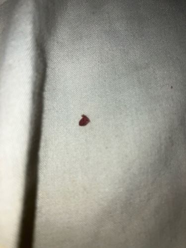Unidentifiable insect remains/blood stain