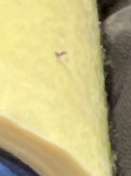 Unidentifiable due to image quality and resolution