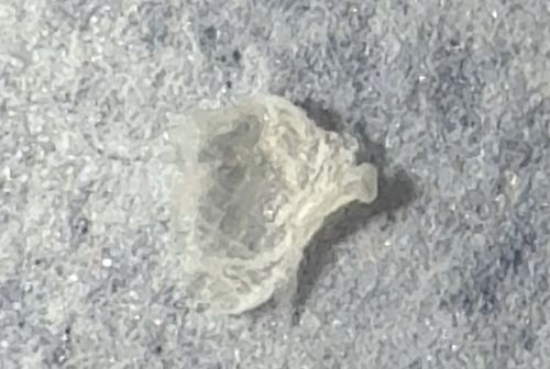 Human Skin Flake or Scab (Not a Bug)