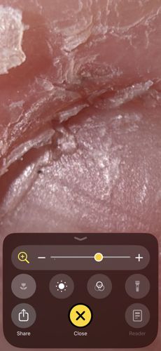 Itch mite / Scabies mite