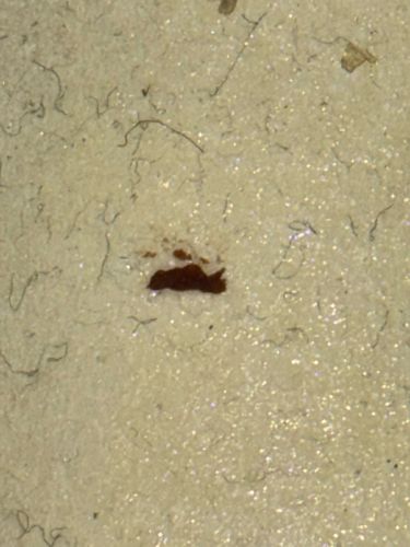 Blood specks or dried fluid (not an insect)