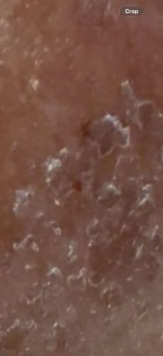 Unidentifiable Object (Likely skin flakes or debris, not an insect)